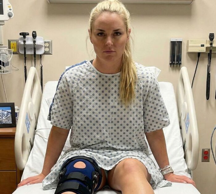 Lindsey Vonn injury update after complex tibia fracture at 2026 Winter Olympics
